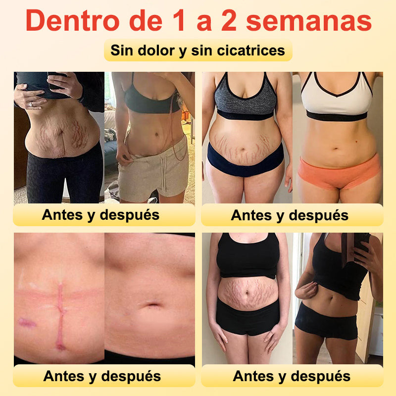 Shorts moldeadores de turmalina y fibra de titanio con calentamiento automático 💙Recomendado por A.M.A.