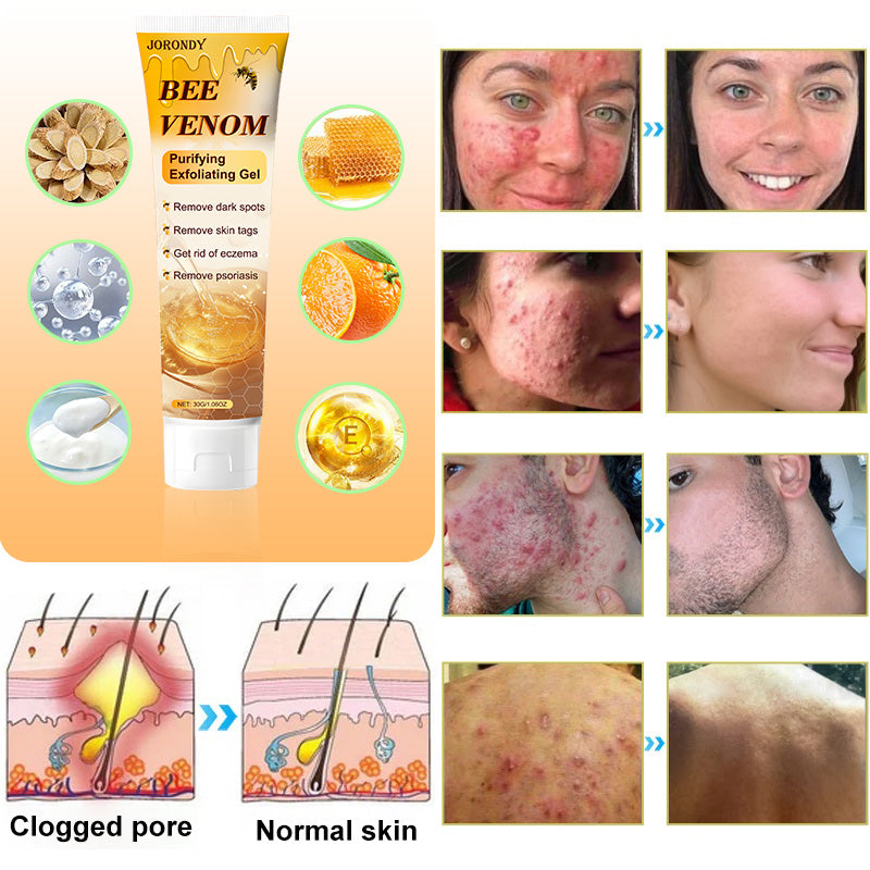 Jorondy™ Bee Venom Purifying Exfoliating Gel 🐝