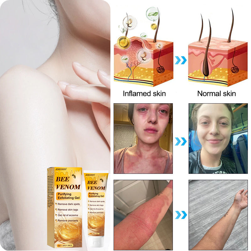 Jorondy™ Bee Venom Purifying Exfoliating Gel 🐝