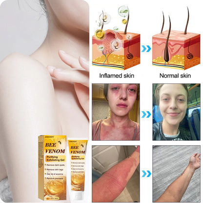 Jorondy™ Bee Venom Purifying Exfoliating Gel 🐝