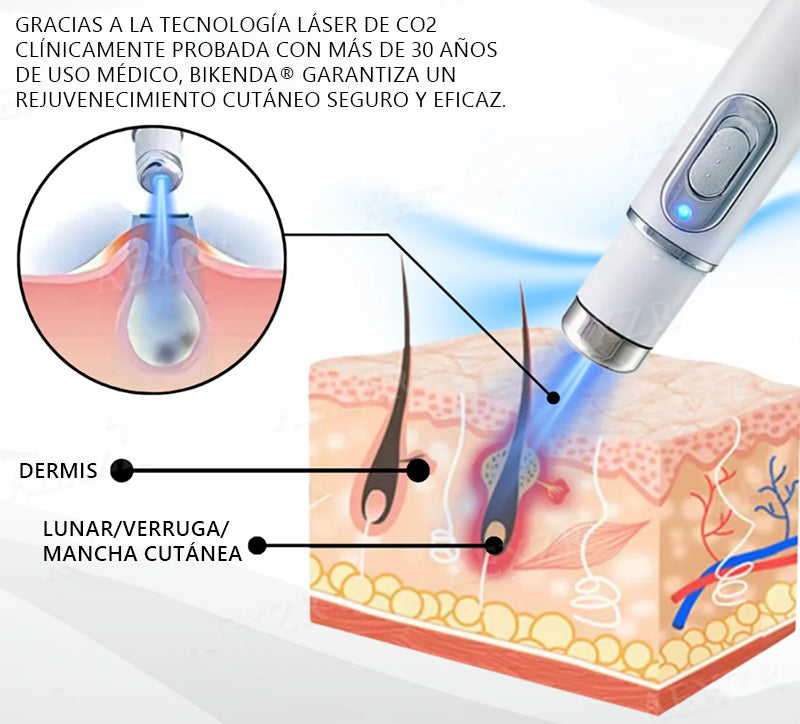 Lápiz láser no invasivo Bikenda® para la eliminación de lunares y verrugas