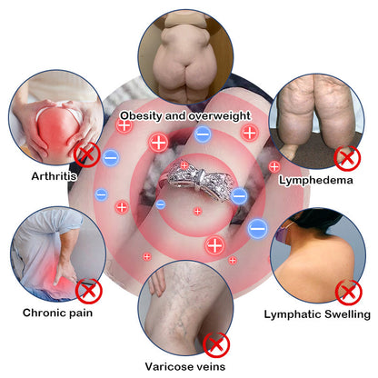 80% OFF 🔥🔥CZTICLE Lymphatic Magnetic Therapy Butterfly Ring