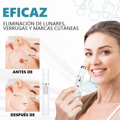Lápiz láser no invasivo Bikenda® para la eliminación de lunares y verrugas
